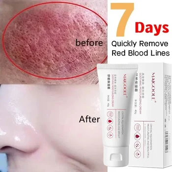 Крем за премахване на зачервяване на лицето Бързо Лечение на Зачервяване на Чувствителната кожа, Розацея, Сърбеж, Незабавно възстановяване на кожата със съдови звездички Корейска Козметика