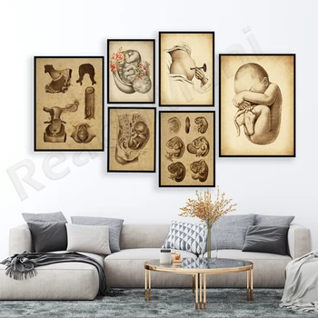 Цветен плакат Obgyn, Плодът в утробата на майката, Близнаци, Плацентата, Изкуството на раждането, Развитието на ембриона, Изкуство акушерки при бременност, на Женската Анатомия